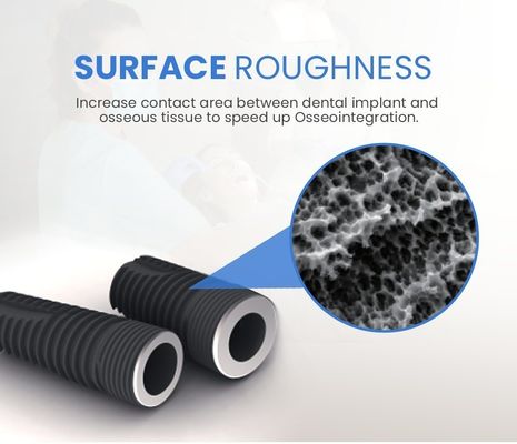 Implante dental personalizado 2D/3D Abutment protésico para implantes de cuello regulares estrechos